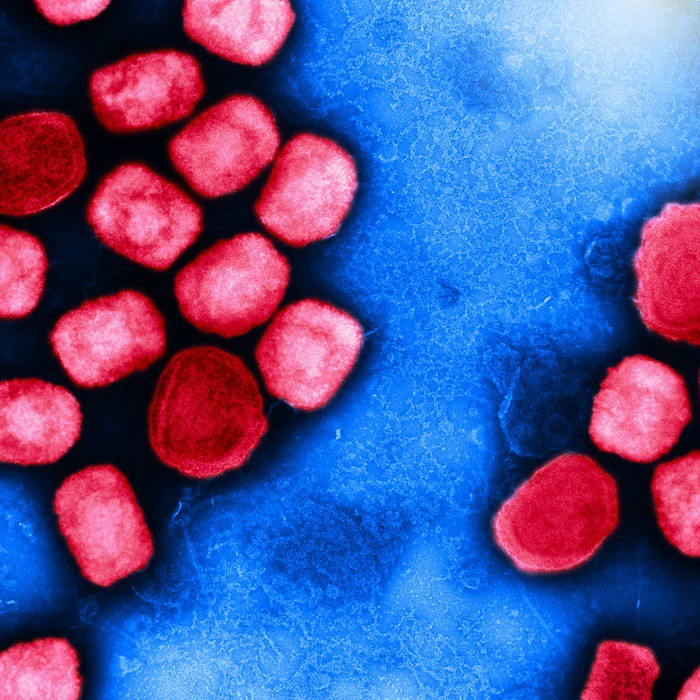 Archivo - Micrografía electrónica de transmisión coloreada de partículas del virus de la viruela del mono (rojo) cultivadas y purificadas a partir de un cultivo celular.